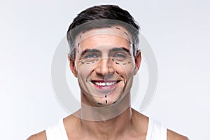 Man marked with lines for plastic surgery