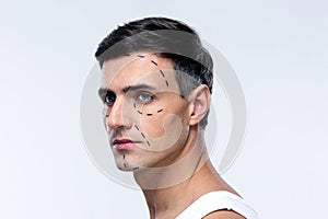 Man marked with lines for plastic surgery