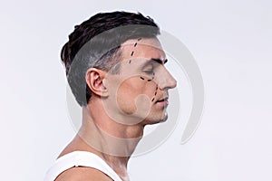 Man marked with lines for plastic surgery photo