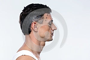Man marked with lines for plastic surgery