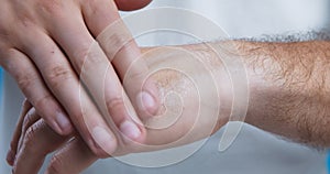 Man moisturizing dry skin of his hands, eczema prevention, close up