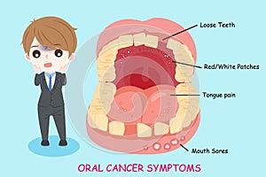 Man with oral cancer symptoms photo