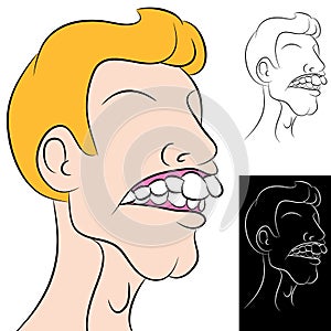 Man With Overbite