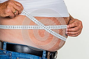 Man with overweight img
