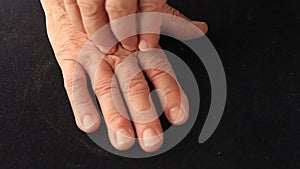 Man with pain on back of his hand