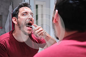 Man in pain while using a spray to treat an aphthae or sore on his throat. photo