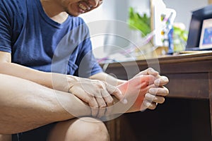 Man with painful and inflamed gout photo