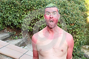 Man with pale complexion getting sunburnt