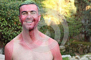 Man with pale complexion getting sunburnt