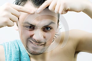 Man picking pimple. photo