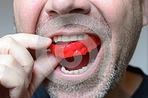 Man placing a red bite plate in his mouth