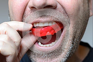 Man placing a red bite plate in his mouth photo