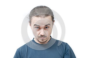 Man portrait wrikled face. bearded man looking with skin pucker isolated on white background