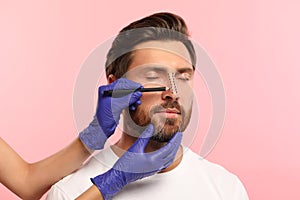 Man preparing for cosmetic surgery, pink background. Doctor drawing markings on his face, closeup