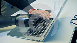 Man prosthetic and normal hands are typing on the keyboard.