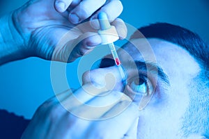 Man is putting drops in his eyes. Medical treatment concept. Allergic conjunctivitis problem