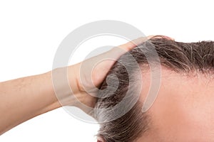 Man with receding hairline, closeup isolated on white, concept a