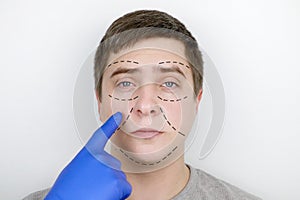 A man at the reception at the plastic surgeon. Before plastic surgery: eyebrow, forehead, chin and cheek lift