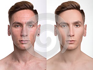 Man before and after retouch