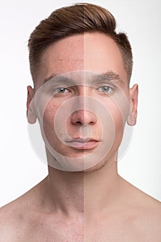 Man before and after retouch