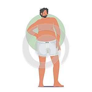 Man with Round Body Shape Stand with Arm Akimbo, Male Character Apple Figure Type with Big Belly and Buttocks Posing