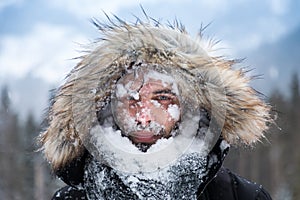 Man`s face covered with snow