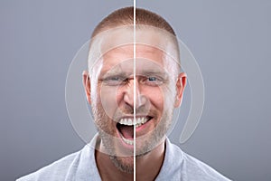 Man's Face Showing Anger And Happy Emotions