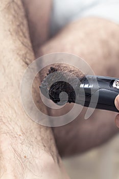 The man`s hand holds an electric hair clipper and cuts long dark hair on his legs.