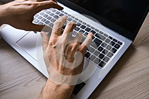 Man& x27;s hands typing on laptop keyboard top view