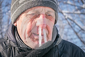 The man`s snot was frozen in his nose. Portrait of an elderly man with icicles in his nose. Runny nose in the winter forest. Frost