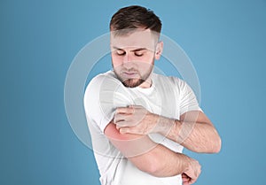 Man scratching arm. Allergy symptoms