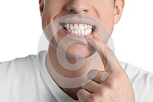 Man showing healthy gums on white background, closeup