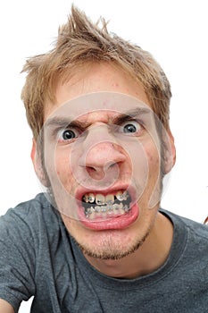 Man showing his braces