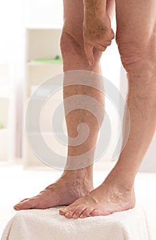 Man showing Varicose veins closeup, foot on modular bath step