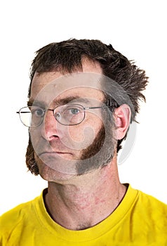 Man with Sideburns
