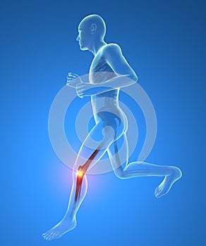 Man, skeleton, running, knee pain inflammation