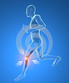 Man, skeleton, running, knee pain inflammation