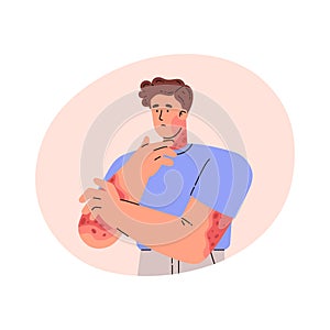 Man with skin problem on hands. Vector illustration in flat style.