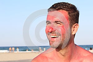 Man smiling while getting sunburned