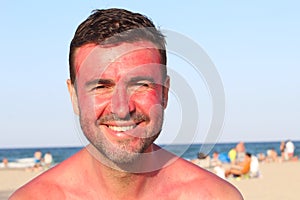Man smiling while getting sunburned