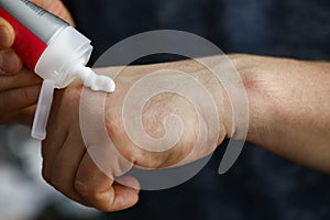 Man squeezes cream on his hand to moisturize skin photo