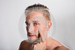 Man Squeezing Pimple On His Face