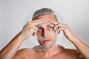 Man Squeezing Pimple On His Forehead