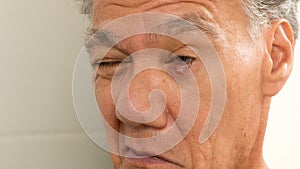 Man with stye on eyelid