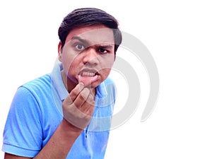 Man suffer from mouth ulcer on lips also known as aphthae painfull feeling photo