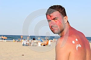 Man suffering the consequences of too much uv light exposure