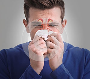 Man suffering from runny nose as allergy symptom. Sinuses illustration