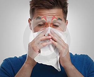 Man suffering from runny nose as allergy symptom. Sinuses illustration