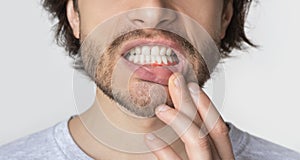 Man suffering from toothache, tooth decay or sensitivity