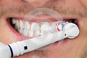 Man Teeth With Electric Toothbrush